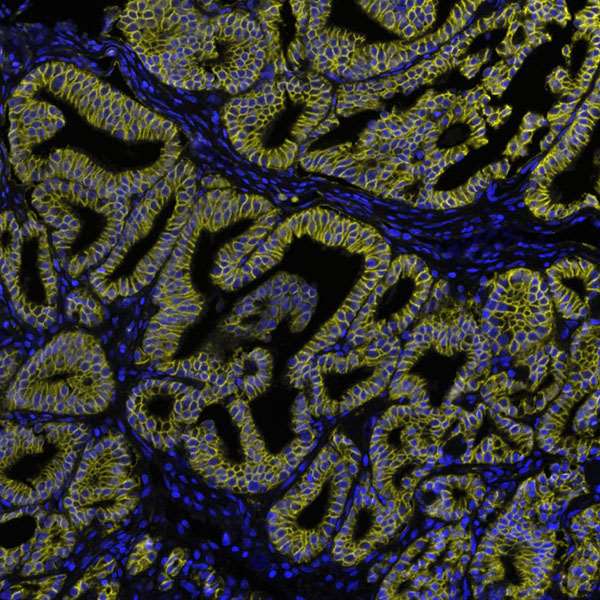 Immunohistochemistry (Formalin/PFA-fixed paraffin-embedded sections) - Anti-beta Catenin antibody [BLR086G] - BSA free (ab272069), expandable thumbnail