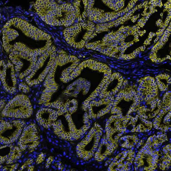 Immunohistochemistry (Formalin/PFA-fixed paraffin-embedded sections) - Anti-beta Catenin antibody [BLR086G] - BSA free (AB272069)