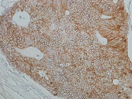 Immunohistochemistry (Formalin/PFA-fixed paraffin-embedded sections) - Anti-beta Catenin antibody [BLR086G] - BSA free (AB272069)