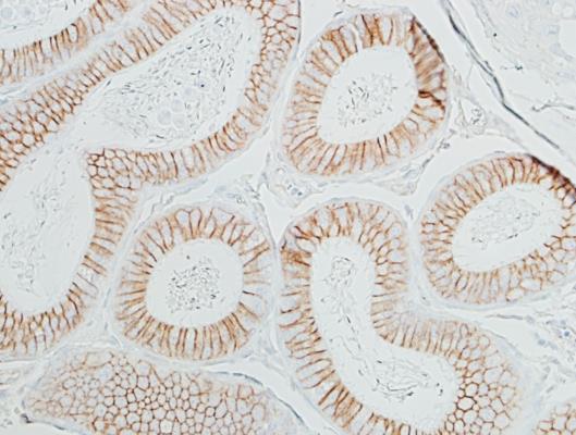 Immunohistochemistry (Formalin/PFA-fixed paraffin-embedded sections) - Anti-beta Catenin antibody [BLR086G] - BSA free (AB272069), expandable thumbnail