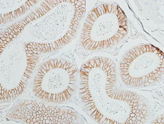 Immunohistochemistry (Formalin/PFA-fixed paraffin-embedded sections) - Anti-beta Catenin antibody [BLR086G] - BSA free (AB272069)