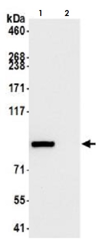 Immunoprecipitation - Anti-beta Catenin antibody [BLR086G] - BSA free (AB272069), expandable thumbnail