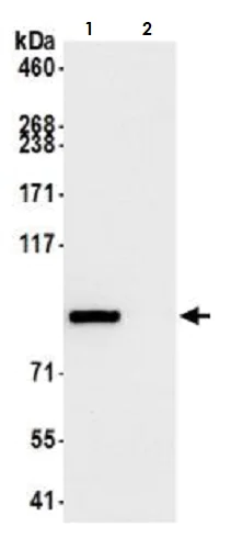 Immunoprecipitation - Anti-beta Catenin antibody [BLR086G] - BSA free (AB272069)