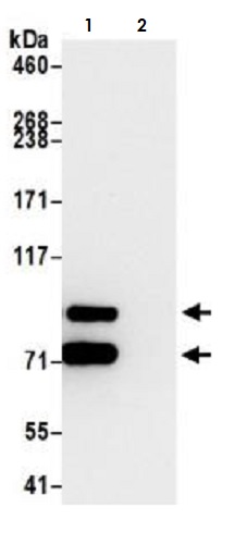 Immunoprecipitation - Anti-beta Catenin antibody [BLR086G] - BSA free (ab272069), expandable thumbnail