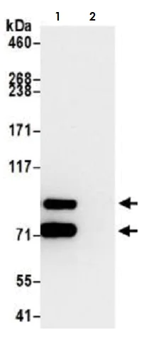 Immunoprecipitation - Anti-beta Catenin antibody [BLR086G] - BSA free (AB272069)