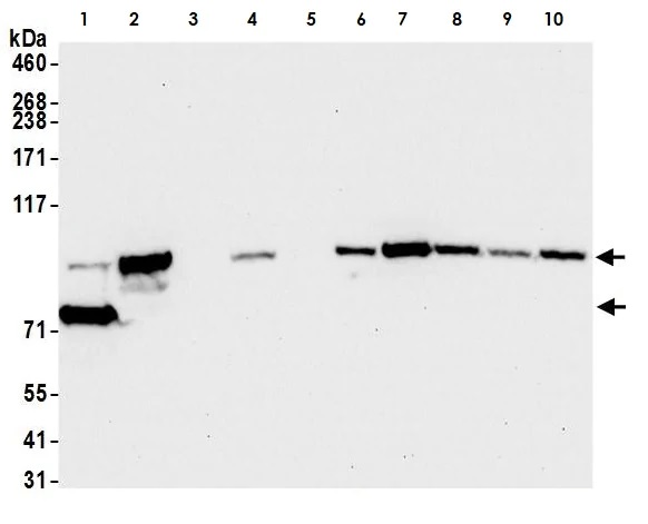Western blot - Anti-beta Catenin antibody [BLR086G] - BSA free (AB272069), expandable thumbnail