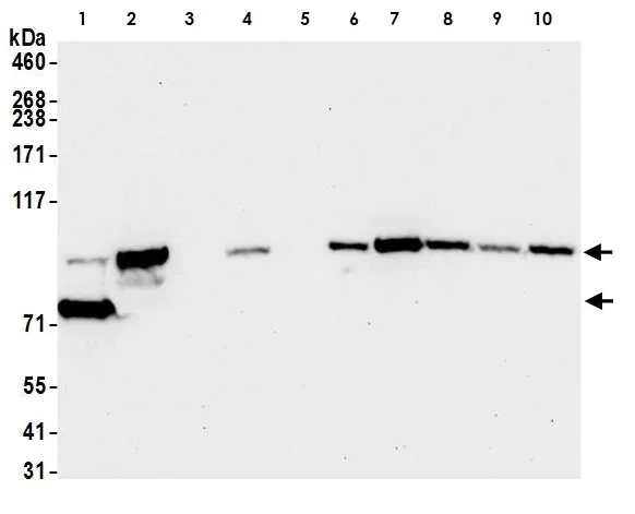 Western blot - Anti-beta Catenin antibody [BLR086G] - BSA free (AB272069)