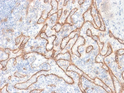 Immunohistochemistry (Formalin/PFA-fixed paraffin-embedded sections) - Anti-beta Catenin antibody [CTNNB1/2030R] (AB237984)