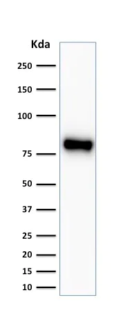 Western blot - Anti-beta Catenin antibody [CTNNB1/2030R] (AB237984)