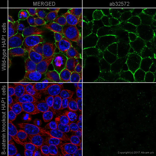 Immunocytochemistry/ Immunofluorescence - Anti-beta Catenin antibody [E247] - BSA and Azide free (AB196204)