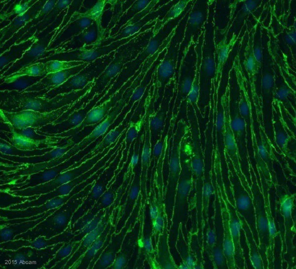 Immunocytochemistry/ Immunofluorescence - Anti-beta Catenin antibody [E247] - BSA and Azide free (AB196204)