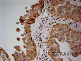 Immunohistochemistry (Formalin/PFA-fixed paraffin-embedded sections) - Anti-beta Catenin antibody [E247] - BSA and Azide free (AB196204)