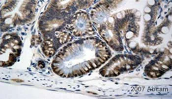 Immunohistochemistry (Formalin/PFA-fixed paraffin-embedded sections) - Anti-beta Catenin antibody [E247] - BSA and Azide free (AB196204)