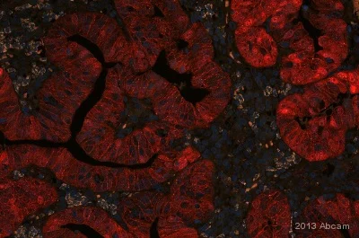 Immunohistochemistry (Formalin/PFA-fixed paraffin-embedded sections) - Anti-beta Catenin antibody [E247] - BSA and Azide free (AB196204)