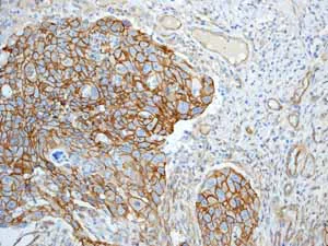 Immunohistochemistry (Formalin/PFA-fixed paraffin-embedded sections) - Anti-beta Catenin antibody [E247] - BSA and Azide free (AB196204)