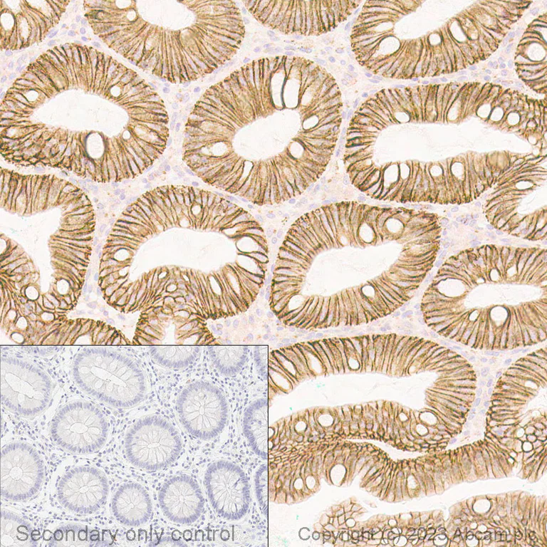 Immunohistochemistry (Formalin/PFA-fixed paraffin-embedded sections) - Anti-beta Catenin antibody [E247] - BSA and Azide free (AB196204)