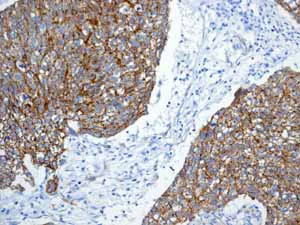Immunohistochemistry (Formalin/PFA-fixed paraffin-embedded sections) - Anti-beta Catenin antibody [E247] - BSA and Azide free (AB196204)