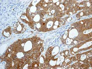 Immunohistochemistry (Formalin/PFA-fixed paraffin-embedded sections) - Anti-beta Catenin antibody [E247] - BSA and Azide free (AB196204)