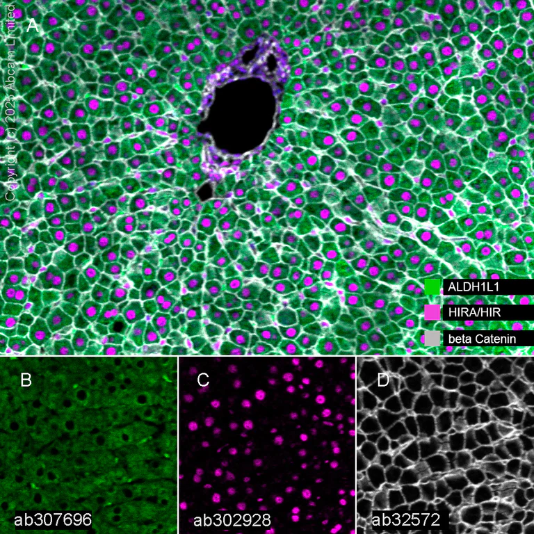 Multiplex immunohistochemistry - Anti-beta Catenin antibody [E247] - BSA and Azide free (AB196204)