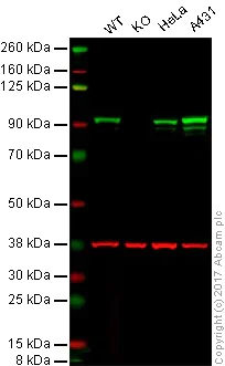 Western blot - Anti-beta Catenin antibody [E247] - BSA and Azide free (AB196204)