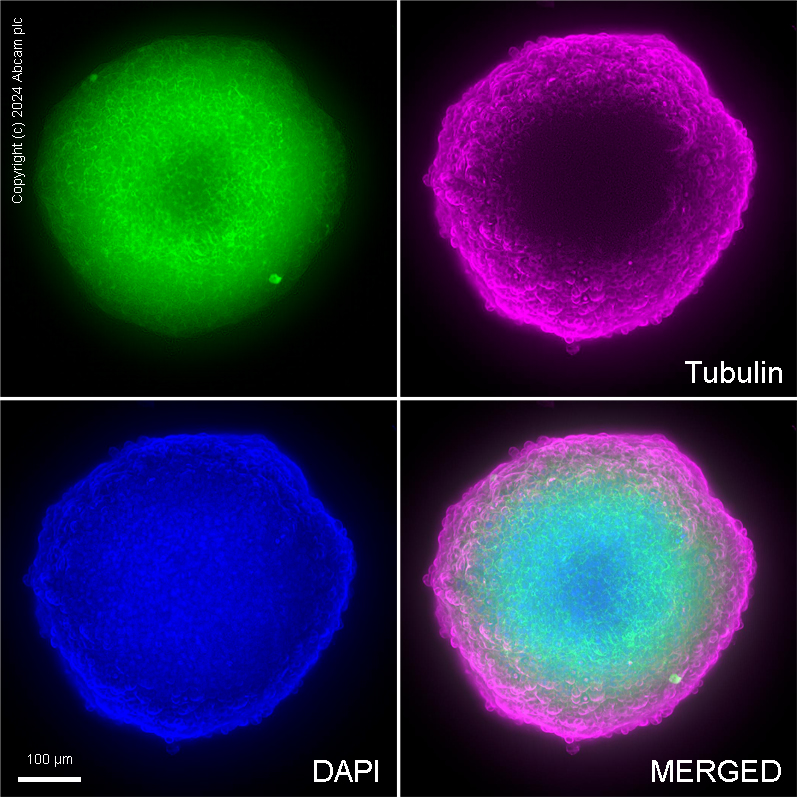 Immunocytochemistry - Anti-beta Catenin antibody [E247] - ChIP Grade (ab32572), expandable thumbnail