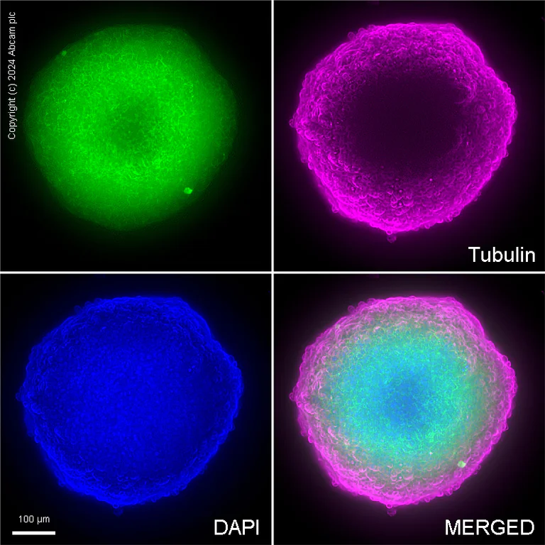 Immunocytochemistry - Anti-beta Catenin antibody [E247] - ChIP Grade (AB32572)