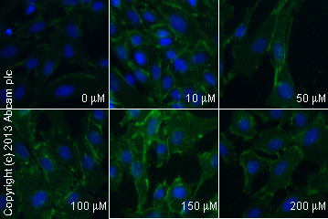 Immunocytochemistry/ Immunofluorescence - Anti-beta Catenin antibody [E247] - ChIP Grade (ab32572), expandable thumbnail