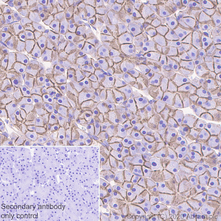 Immunohistochemistry (Formalin/PFA-fixed paraffin-embedded sections) - Anti-beta Catenin antibody [E247] - ChIP Grade (ab32572), expandable thumbnail