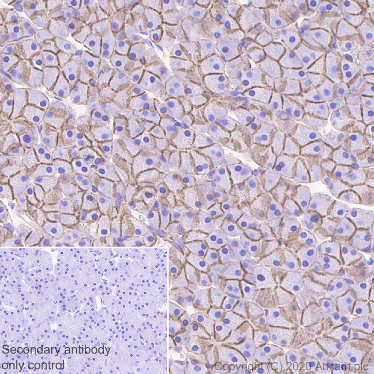 Immunohistochemistry (Formalin/PFA-fixed paraffin-embedded sections) - Anti-beta Catenin antibody [E247] - ChIP Grade (AB32572)