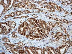 Immunohistochemistry (Formalin/PFA-fixed paraffin-embedded sections) - Anti-beta Catenin antibody [E247] - ChIP Grade (ab32572), expandable thumbnail