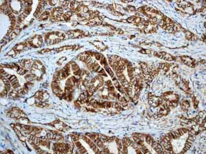 Immunohistochemistry (Formalin/PFA-fixed paraffin-embedded sections) - Anti-beta Catenin antibody [E247] - ChIP Grade (AB32572)
