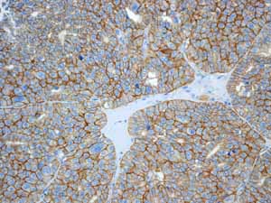 Immunohistochemistry (Formalin/PFA-fixed paraffin-embedded sections) - Anti-beta Catenin antibody [E247] - ChIP Grade (ab32572), expandable thumbnail