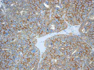 Immunohistochemistry (Formalin/PFA-fixed paraffin-embedded sections) - Anti-beta Catenin antibody [E247] - ChIP Grade (AB32572)