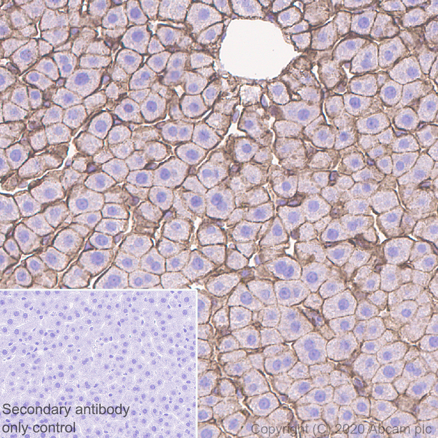 Immunohistochemistry (Formalin/PFA-fixed paraffin-embedded sections) - Anti-beta Catenin antibody [E247] - ChIP Grade (ab32572), expandable thumbnail