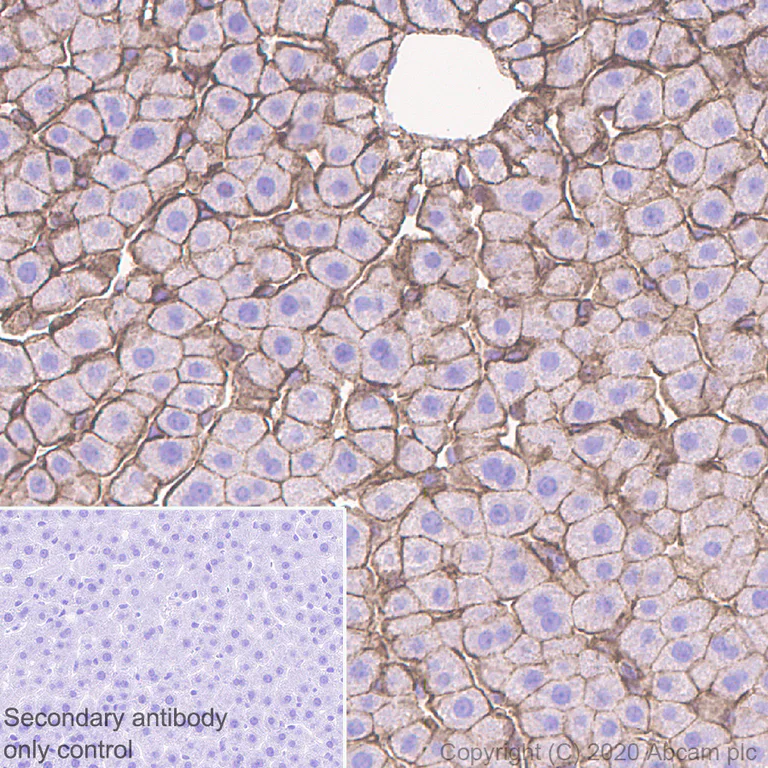 Immunohistochemistry (Formalin/PFA-fixed paraffin-embedded sections) - Anti-beta Catenin antibody [E247] - ChIP Grade (AB32572)