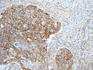 Immunohistochemistry (Formalin/PFA-fixed paraffin-embedded sections) - Anti-beta Catenin antibody [E247] - ChIP Grade (ab32572), expandable thumbnail