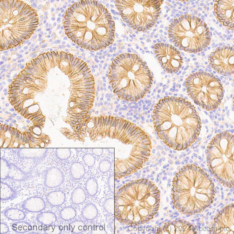 Immunohistochemistry (Formalin/PFA-fixed paraffin-embedded sections) - Anti-beta Catenin antibody [E247] - ChIP Grade (ab32572), expandable thumbnail