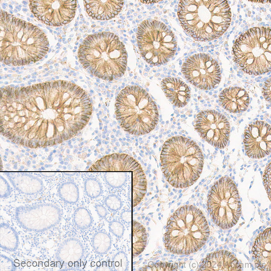 Immunohistochemistry (Formalin/PFA-fixed paraffin-embedded sections) - Anti-beta Catenin antibody [E247] - ChIP Grade (ab32572), expandable thumbnail