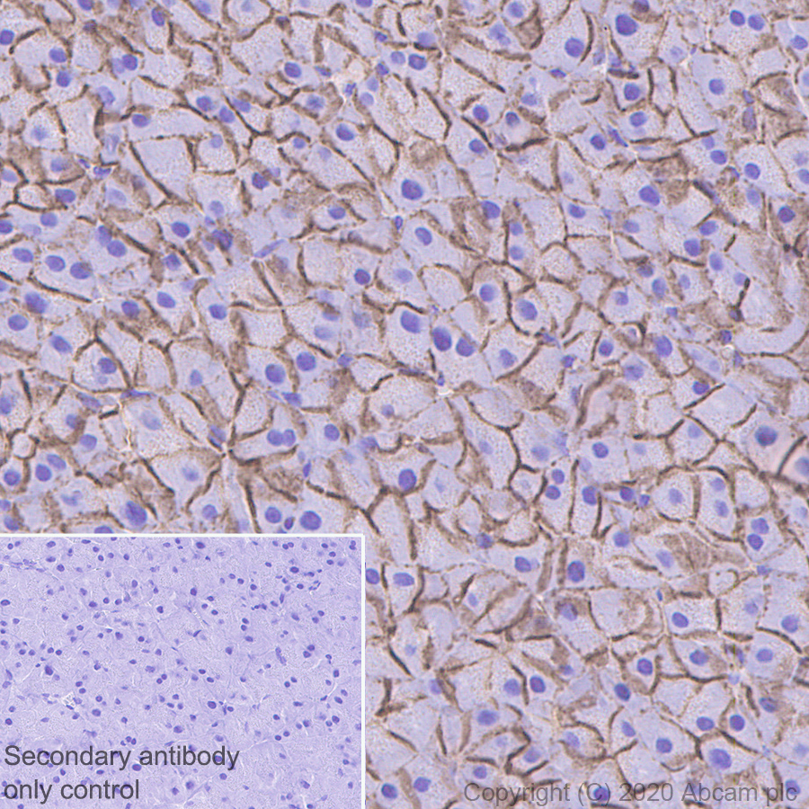 Immunohistochemistry (Formalin/PFA-fixed paraffin-embedded sections) - Anti-beta Catenin antibody [E247] - ChIP Grade (ab32572), expandable thumbnail