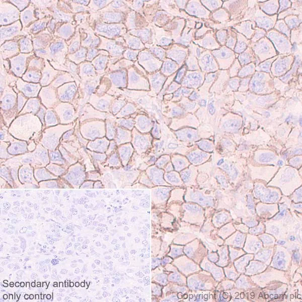 Immunohistochemistry (Formalin/PFA-fixed paraffin-embedded sections) - Anti-beta Catenin antibody [E247] - ChIP Grade (AB32572)