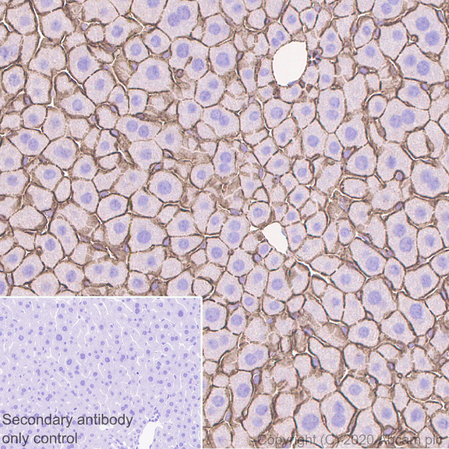 Long-range Regulation of Partially Folded Amyloidogenic