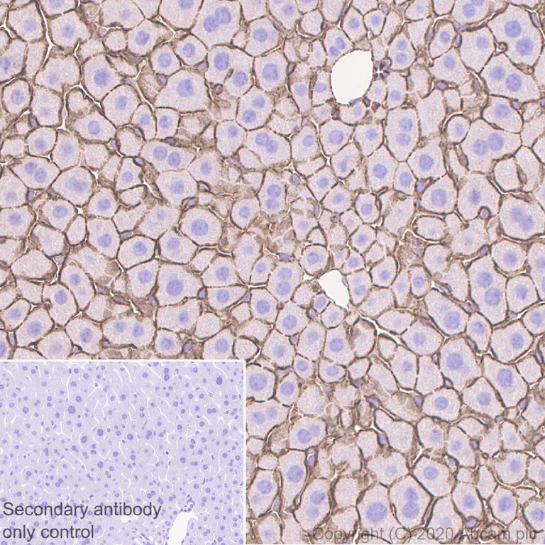Immunohistochemistry (Formalin/PFA-fixed paraffin-embedded sections) - Anti-beta Catenin antibody [E247] - ChIP Grade (AB32572)