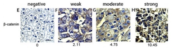 Immunohistochemistry (Formalin/PFA-fixed paraffin-embedded sections) - Anti-beta Catenin antibody [E247] - ChIP Grade (AB32572), expandable thumbnail