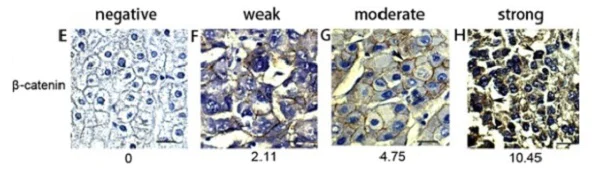 Immunohistochemistry (Formalin/PFA-fixed paraffin-embedded sections) - Anti-beta Catenin antibody [E247] - ChIP Grade (AB32572)