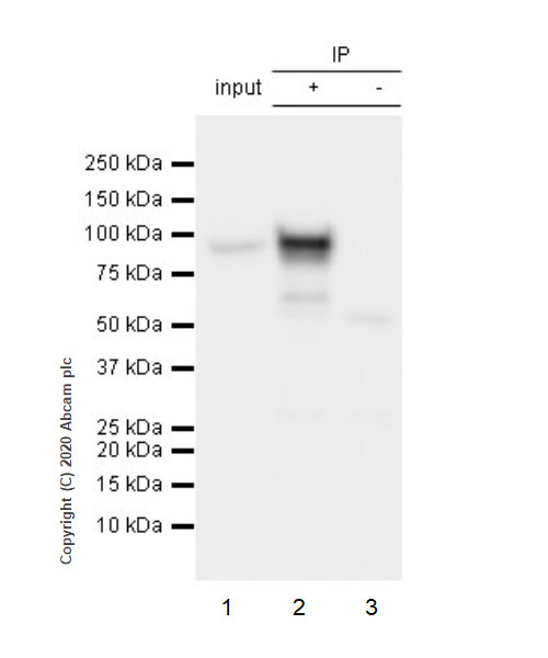 Immunoprecipitation - Anti-beta Catenin antibody [E247] - ChIP Grade (AB32572), expandable thumbnail