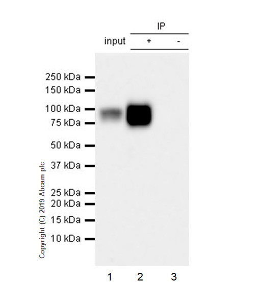 Immunoprecipitation - Anti-beta Catenin antibody [E247] - ChIP Grade (ab32572), expandable thumbnail