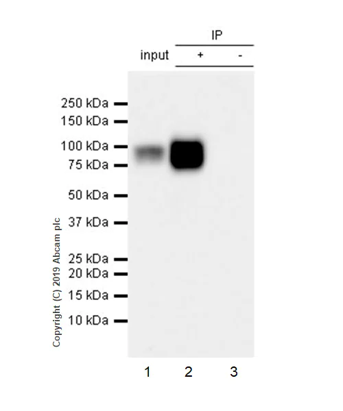 Immunoprecipitation - Anti-beta Catenin antibody [E247] - ChIP Grade (AB32572)