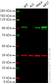 Western blot - Anti-beta Catenin antibody [E247] - ChIP Grade (AB32572), expandable thumbnail