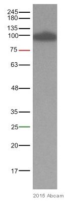 Western blot - Anti-beta Catenin antibody [E247] - ChIP Grade (ab32572), expandable thumbnail