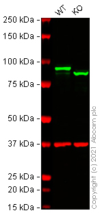 Western blot - Anti-beta Catenin antibody [E247] - ChIP Grade (AB32572), expandable thumbnail